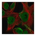 Merck Anti-SGCE antibody produced in rabbit