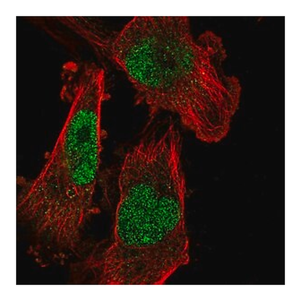 Merck Anti-SETDB1 antibody produced in rabbit