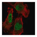 Merck Anti-SETDB1 antibody produced in rabbit