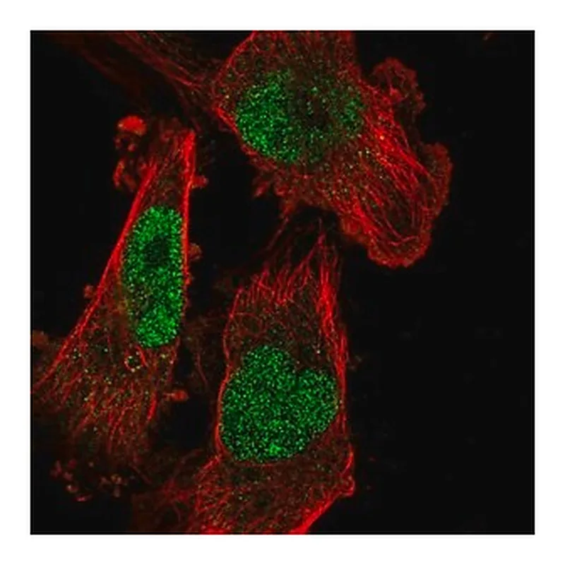 Merck Anti-SETDB1 antibody produced in rabbit