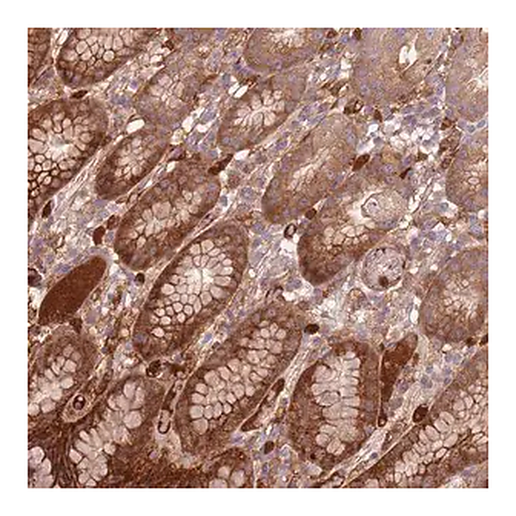 Merck Anti-NADK antibody produced in rabbit