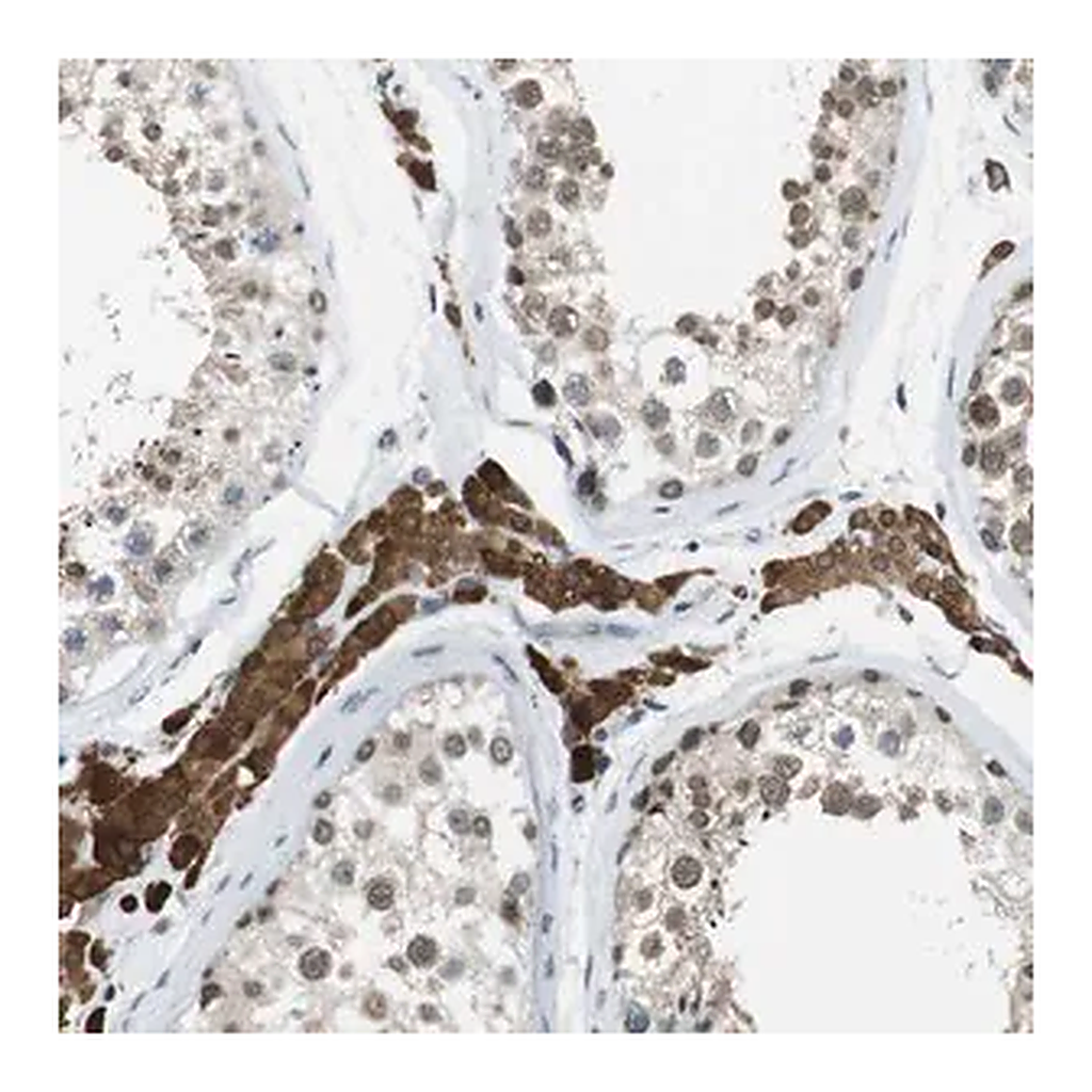Merck Anti-NEK4 antibody produced in rabbit