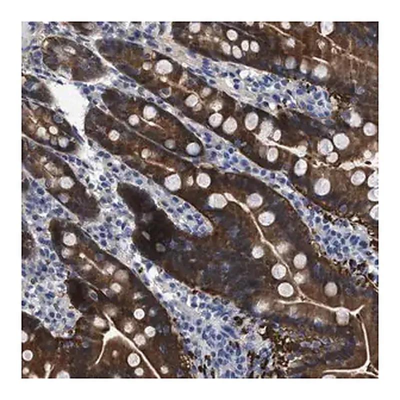 Merck Anti-CBR1 antibody produced in rabbit