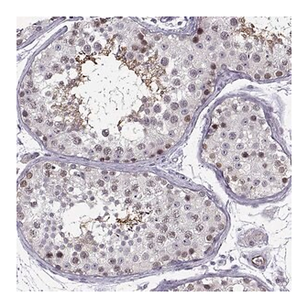 Merck Anti-BACH1 antibody produced in rabbit