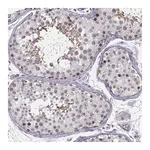 Merck Anti-BACH1 antibody produced in rabbit