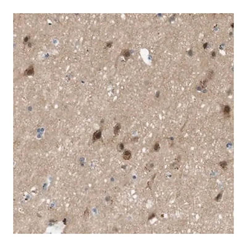 Merck Anti-MAGI2 antibody produced in rabbit