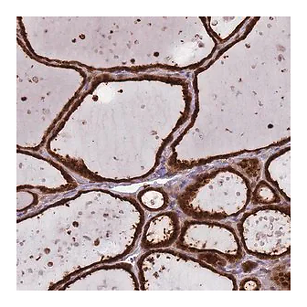 Merck Anti-SALL1 antibody produced in rabbit