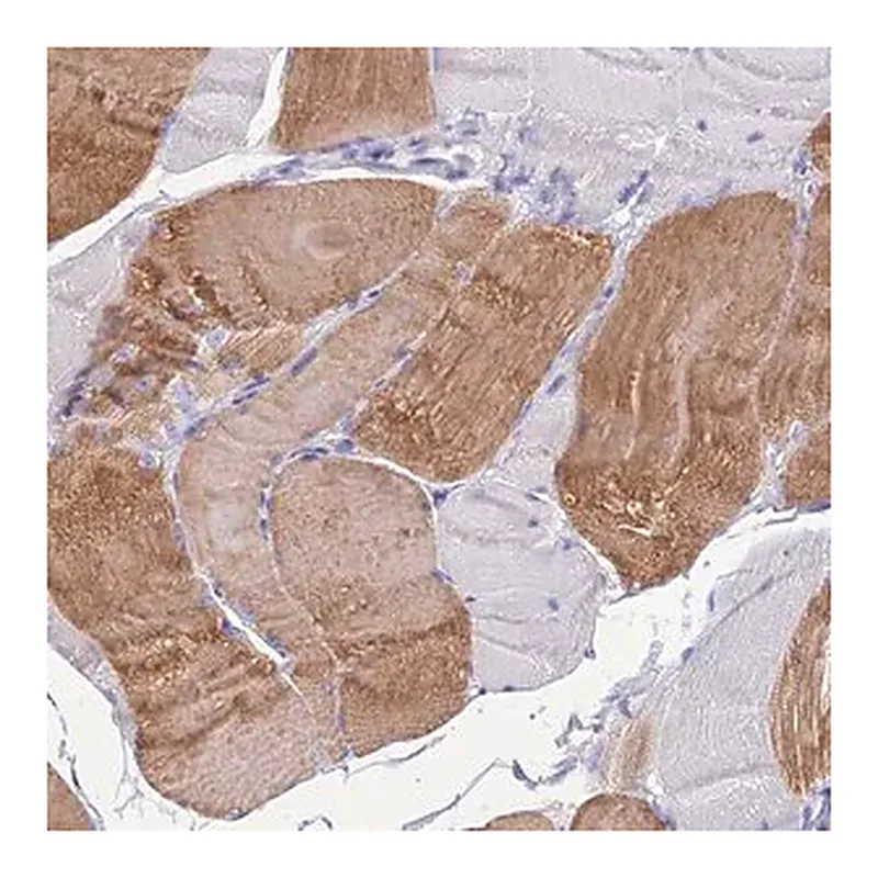 Merck Anti-KIAA0408 antibody produced in rabbit