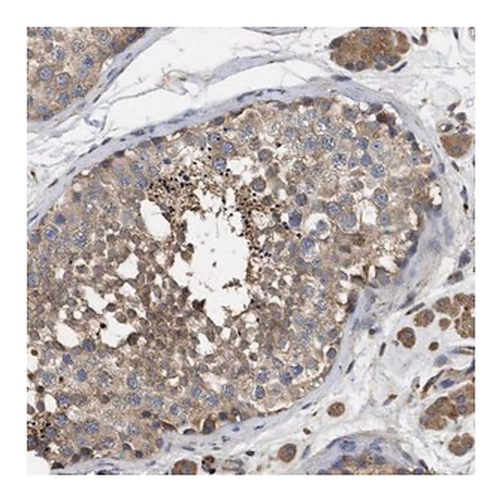 Merck Anti-RNF216 antibody produced in rabbit