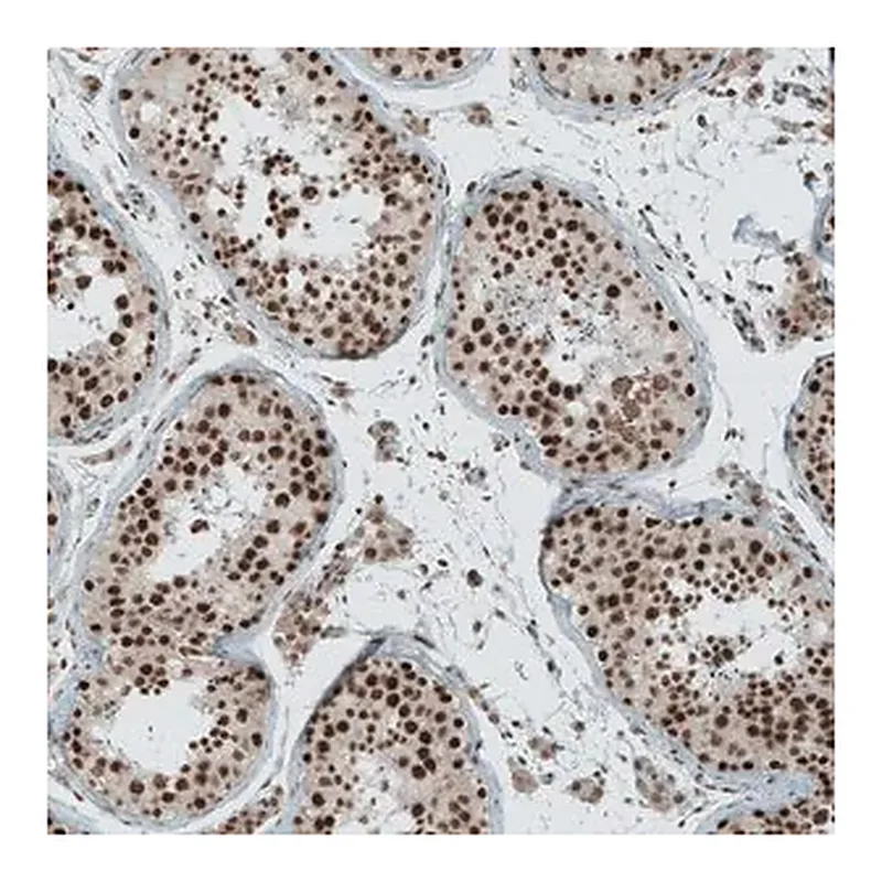 Merck Anti-SENP1 antibody produced in rabbit