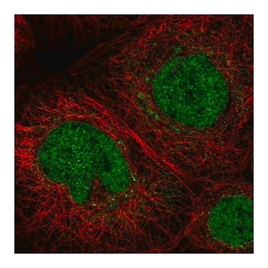 Merck Anti-C11orf63 antibody produced in rabbit