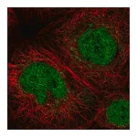 Merck Anti-C11orf63 antibody produced in rabbit