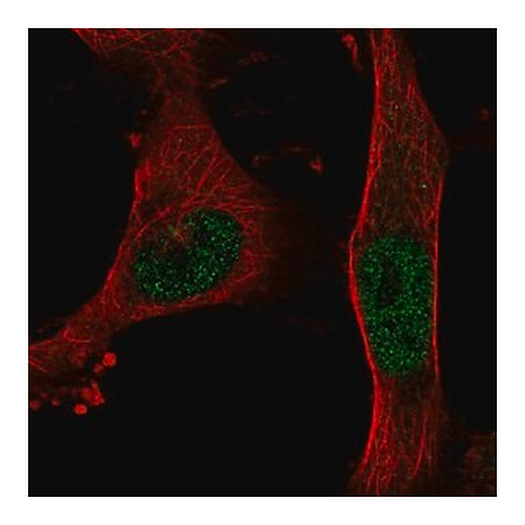 Merck Anti-BNC2 antibody produced in rabbit