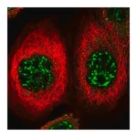 Merck Anti-FOXO4 antibody produced in rabbit