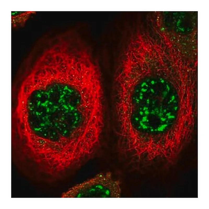 Merck Anti-FOXO4 antibody produced in rabbit
