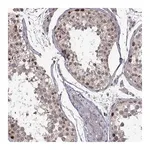 Merck Anti-CHFR antibody produced in rabbit