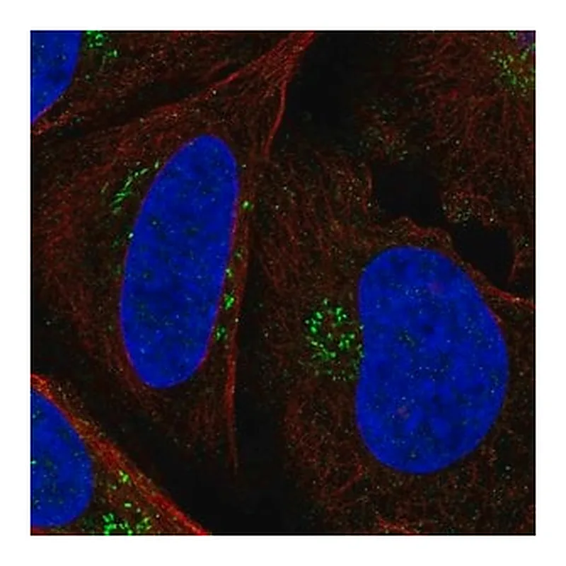 Merck Anti-PTCH1 antibody produced in rabbit