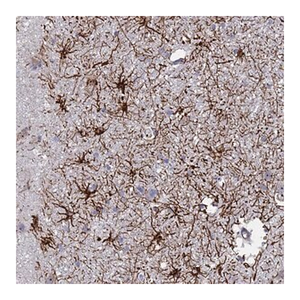 Merck Anti-SYT13 antibody produced in rabbit