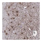Merck Anti-SYT13 antibody produced in rabbit