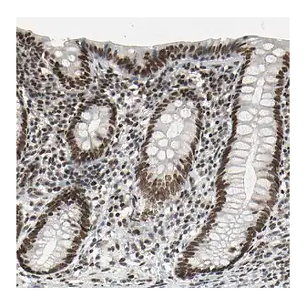 Merck Anti-HMG20A antibody produced in rabbit