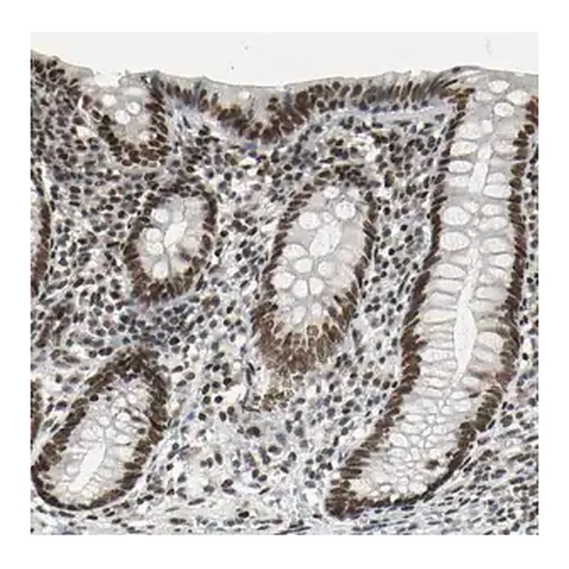 Merck Anti-HMG20A antibody produced in rabbit