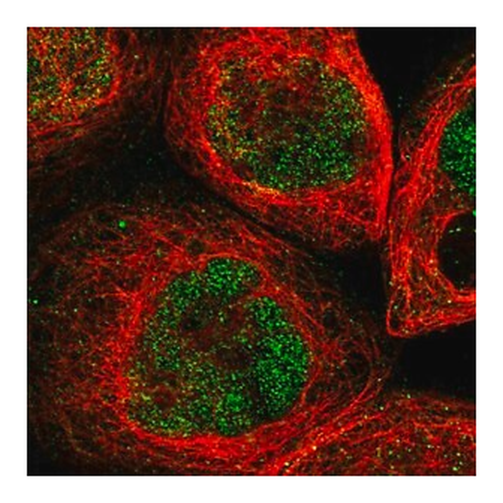 Merck Anti-UBN2 antibody produced in rabbit
