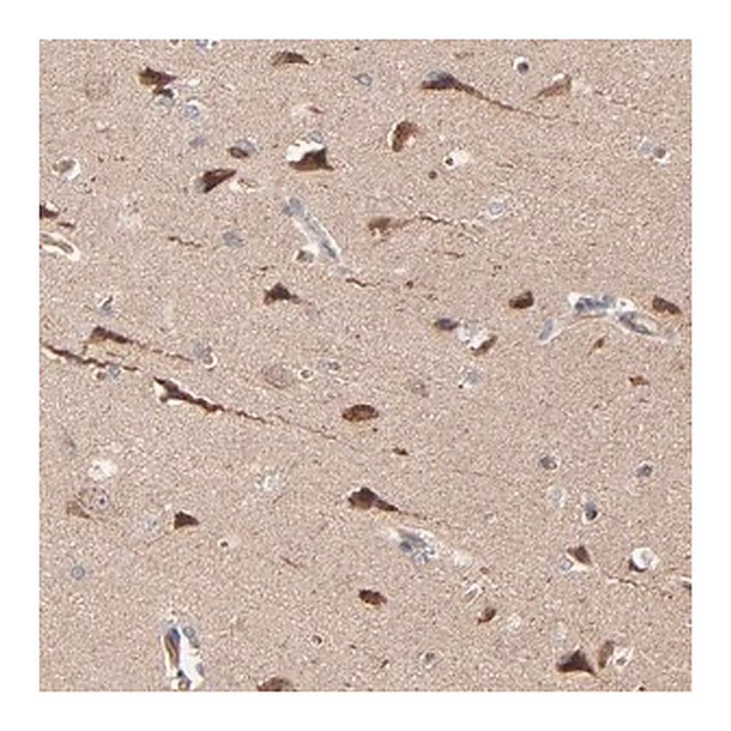 Merck Anti-ABLIM3 antibody produced in rabbit