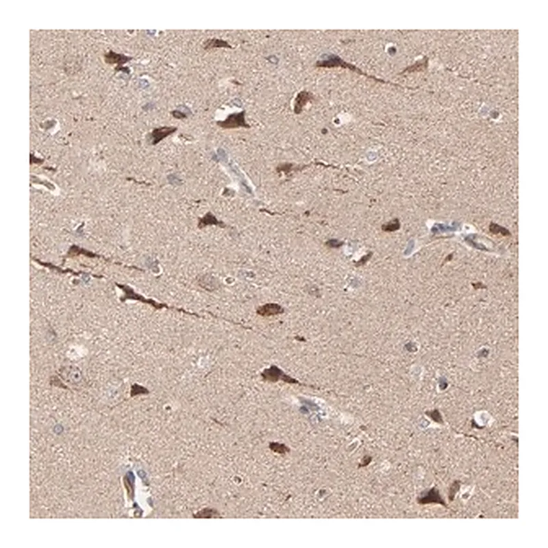 Merck Anti-ABLIM3 antibody produced in rabbit