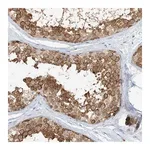 Merck Anti-NAA11 antibody produced in rabbit