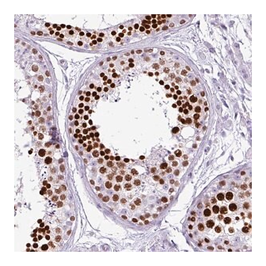 Merck Anti-RBMXL2 antibody produced in rabbit