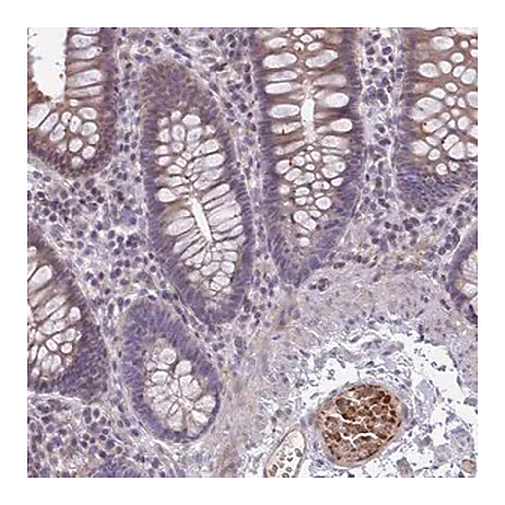 Merck Anti-SLC14A1 antibody produced in rabbit