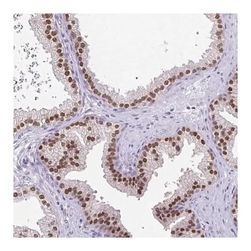 Merck Anti-UBE2Q1 antibody produced in rabbit