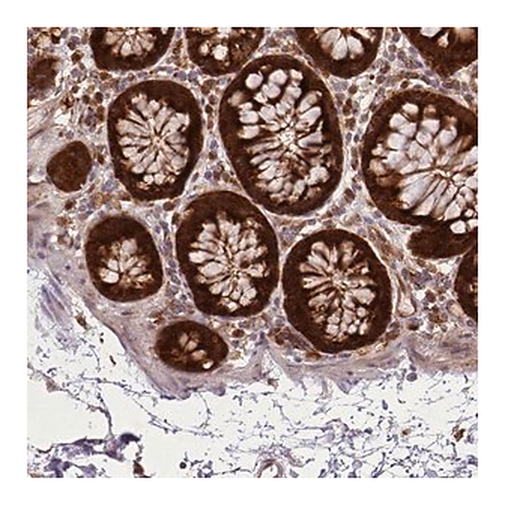 Merck Anti-LGALS9 antibody produced in rabbit