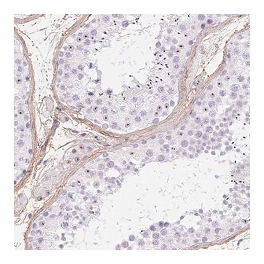 Merck Anti-PDZD2 antibody produced in rabbit