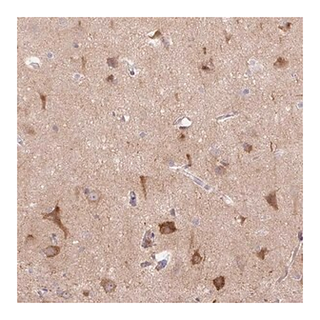 Merck Anti-LRRTM1 antibody produced in rabbit