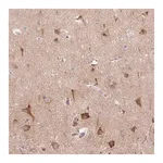 Merck Anti-LRRTM1 antibody produced in rabbit