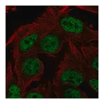 Merck Anti-ST6GALNAC3 antibody produced in rabbit