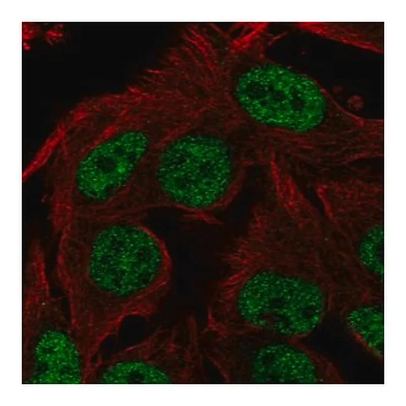 Merck Anti-ST6GALNAC3 antibody produced in rabbit