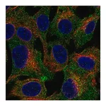 Merck Anti-TRPC4AP antibody produced in rabbit