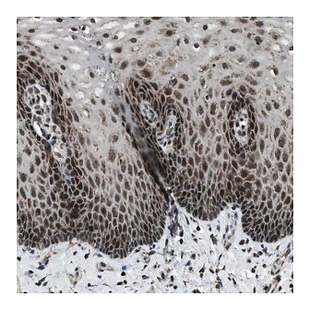 Merck Anti-MORC3 antibody produced in rabbit