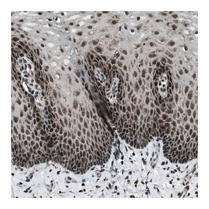 Merck Anti-MORC3 antibody produced in rabbit