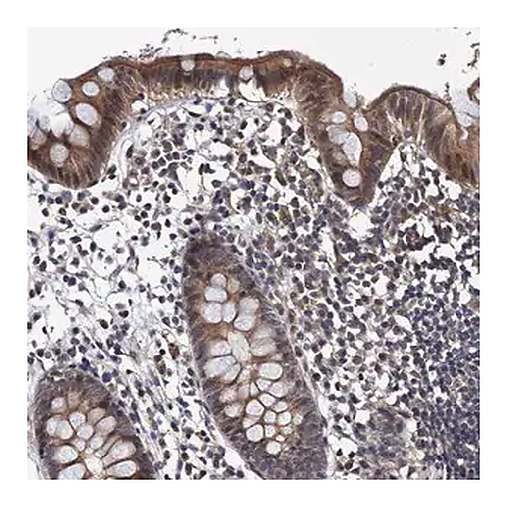 Merck Anti-NAA16 antibody produced in rabbit