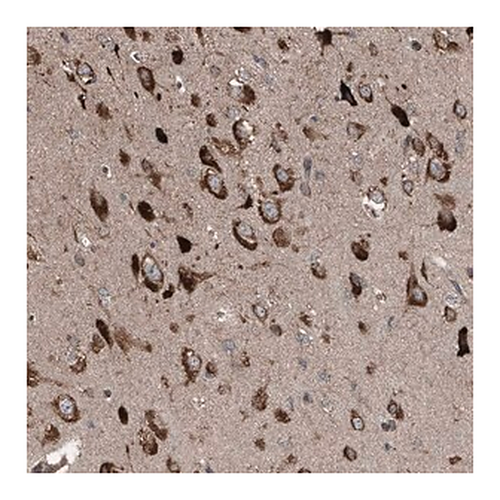 Merck Anti-LIMK1 antibody produced in rabbit
