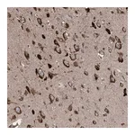 Merck Anti-LIMK1 antibody produced in rabbit