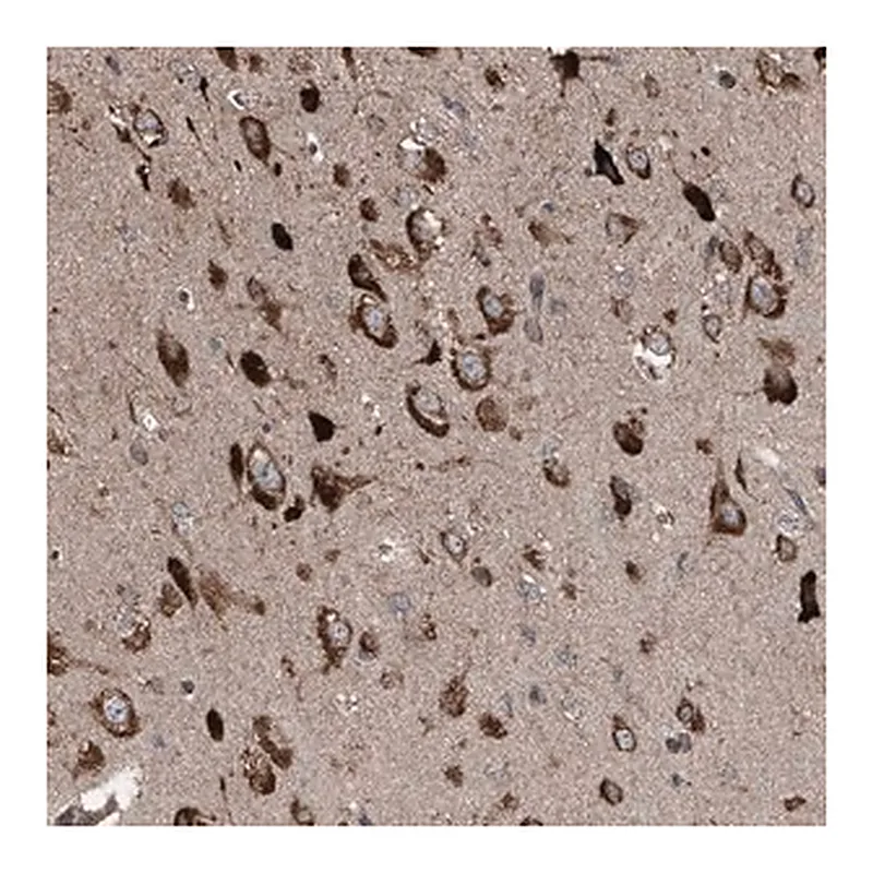 Merck Anti-LIMK1 antibody produced in rabbit
