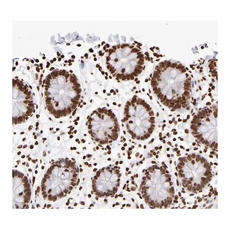 Merck Anti-ZCCHC16 antibody produced in rabbit