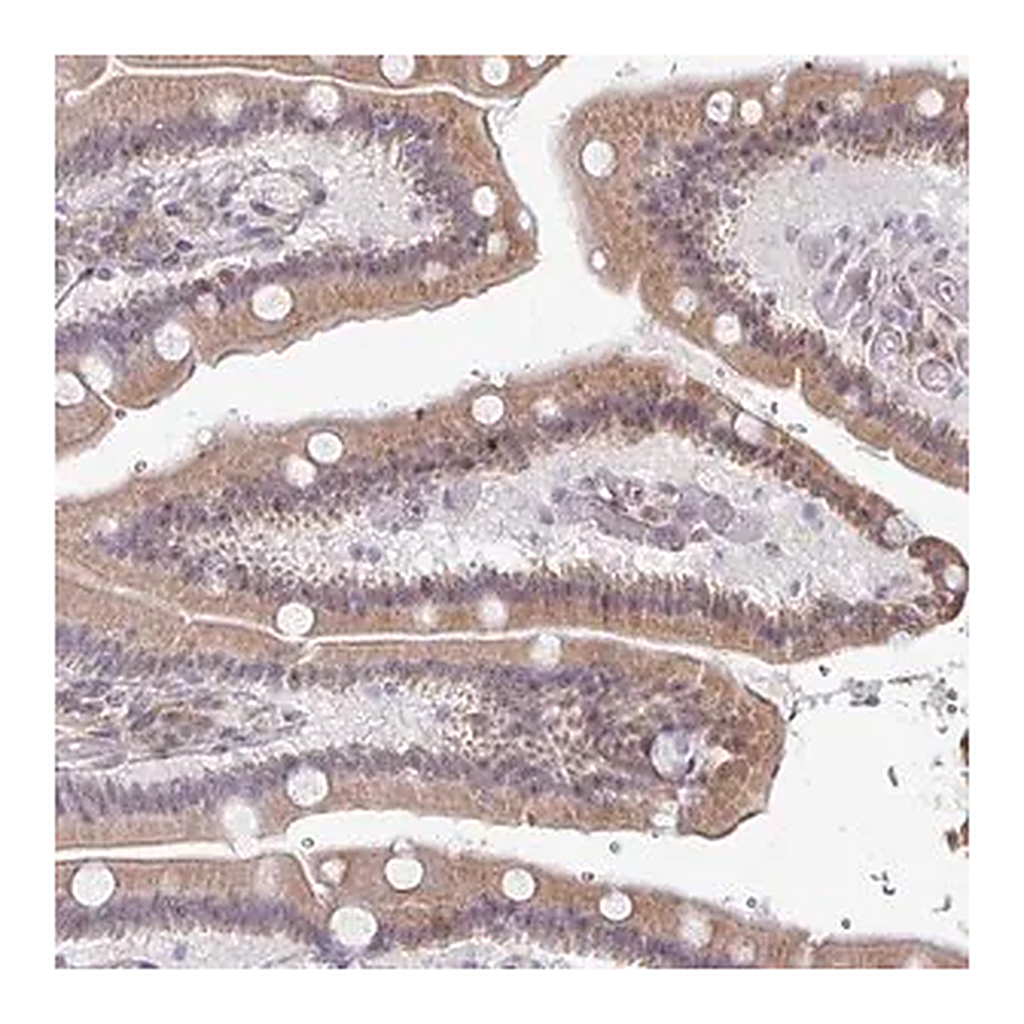 Merck Anti-TMED5 antibody produced in rabbit
