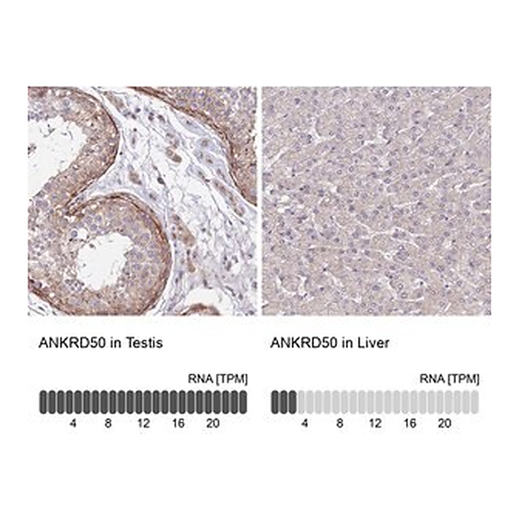 Merck Anti-ANKRD50 antibody produced in rabbit