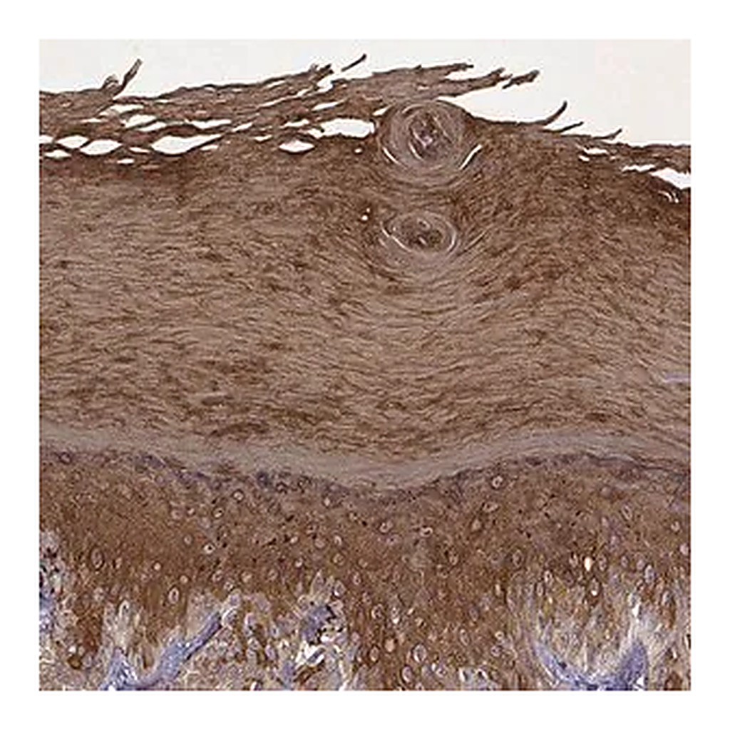 Merck Anti-KRT9 antibody produced in rabbit