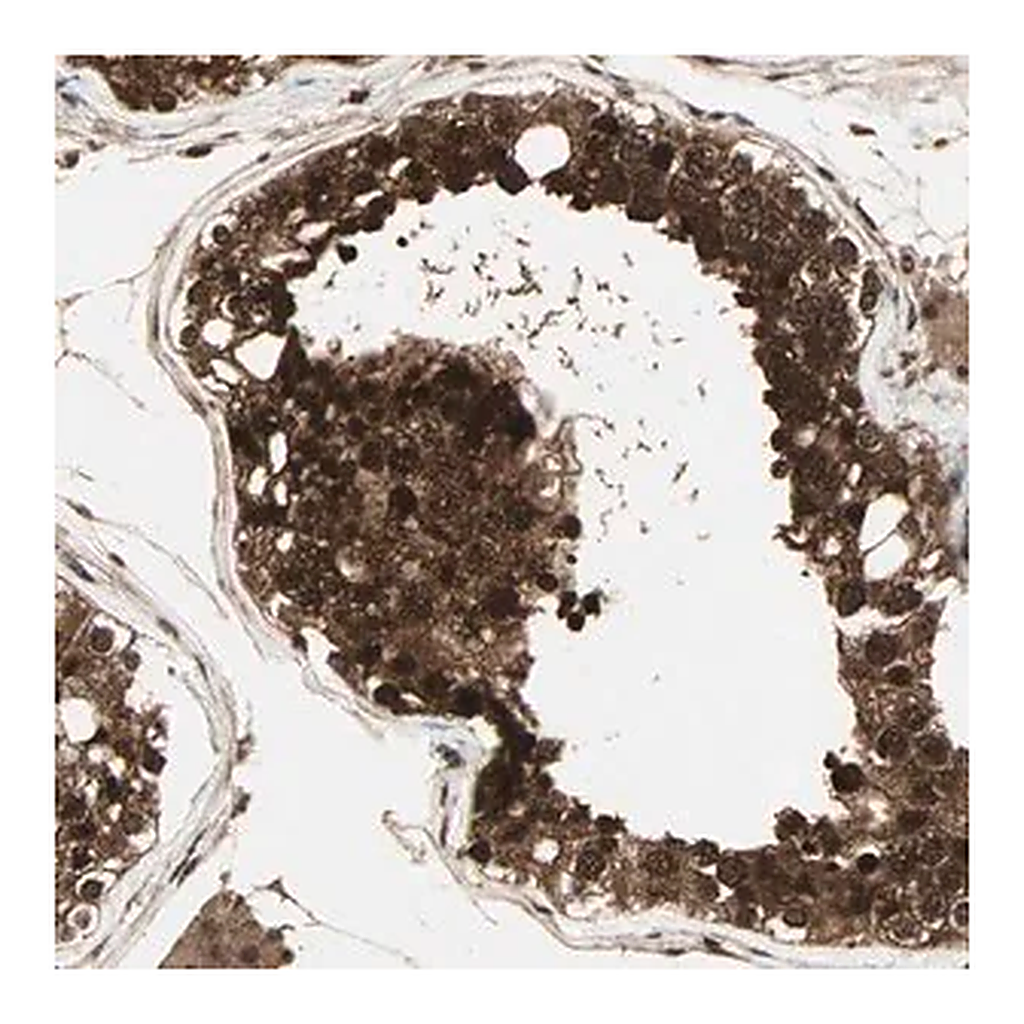 Merck Anti-CSNK2B antibody produced in rabbit